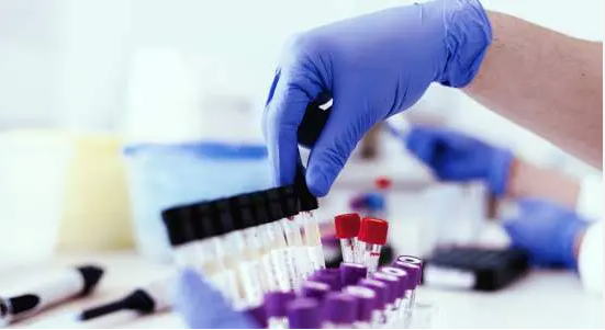 Police propose voluntary drug testing programme
